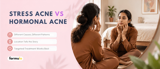 Stress Acne vs Hormonal Acne