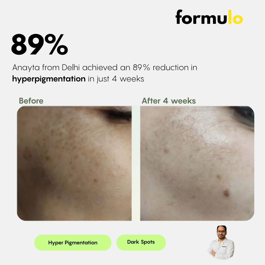 Dermatologist Consultation (Online)