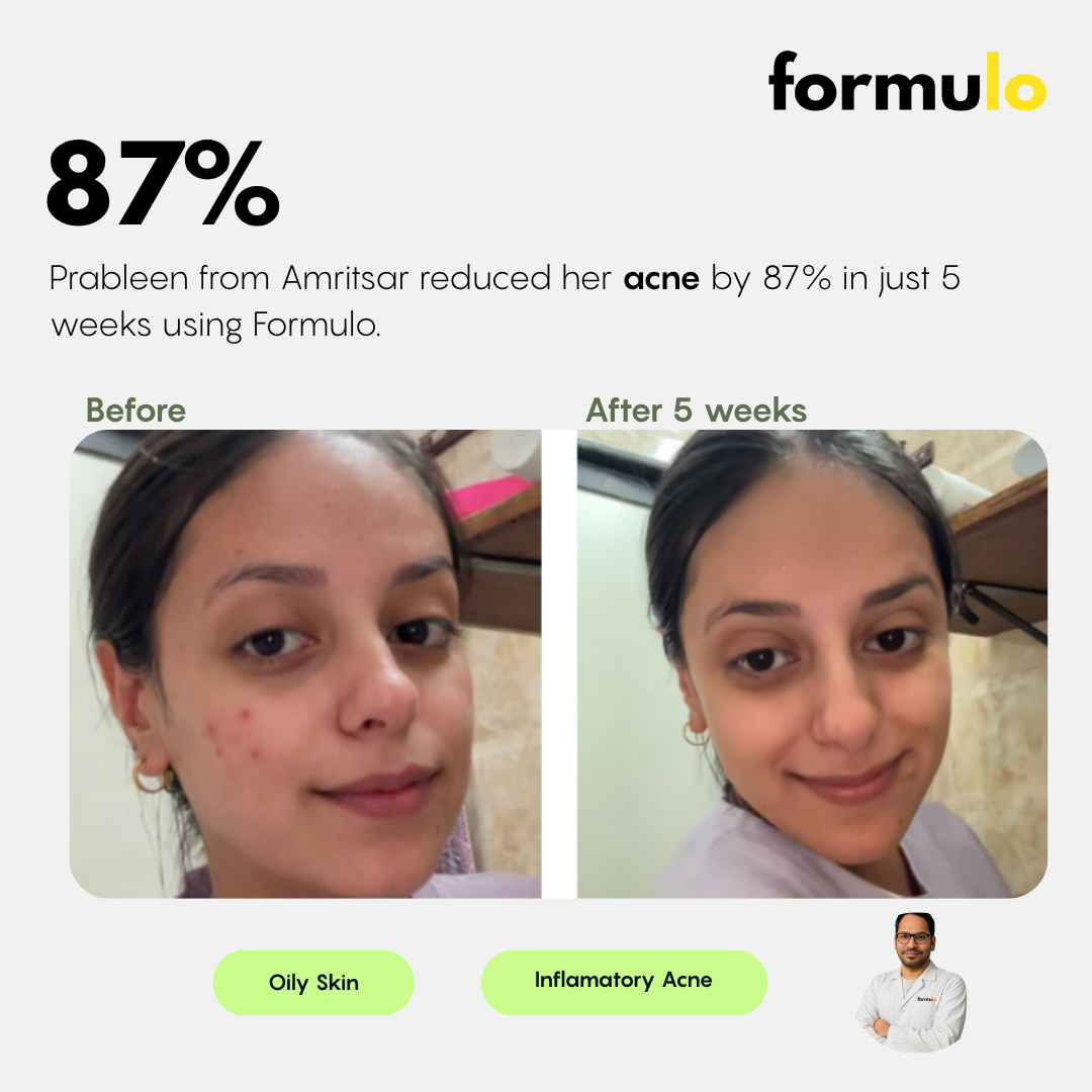 Dermatologist Consultation (Online)