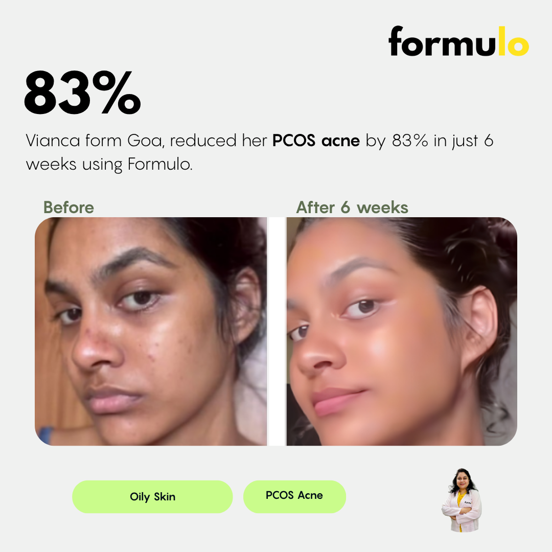 Dermatologist Consultation (Online)
