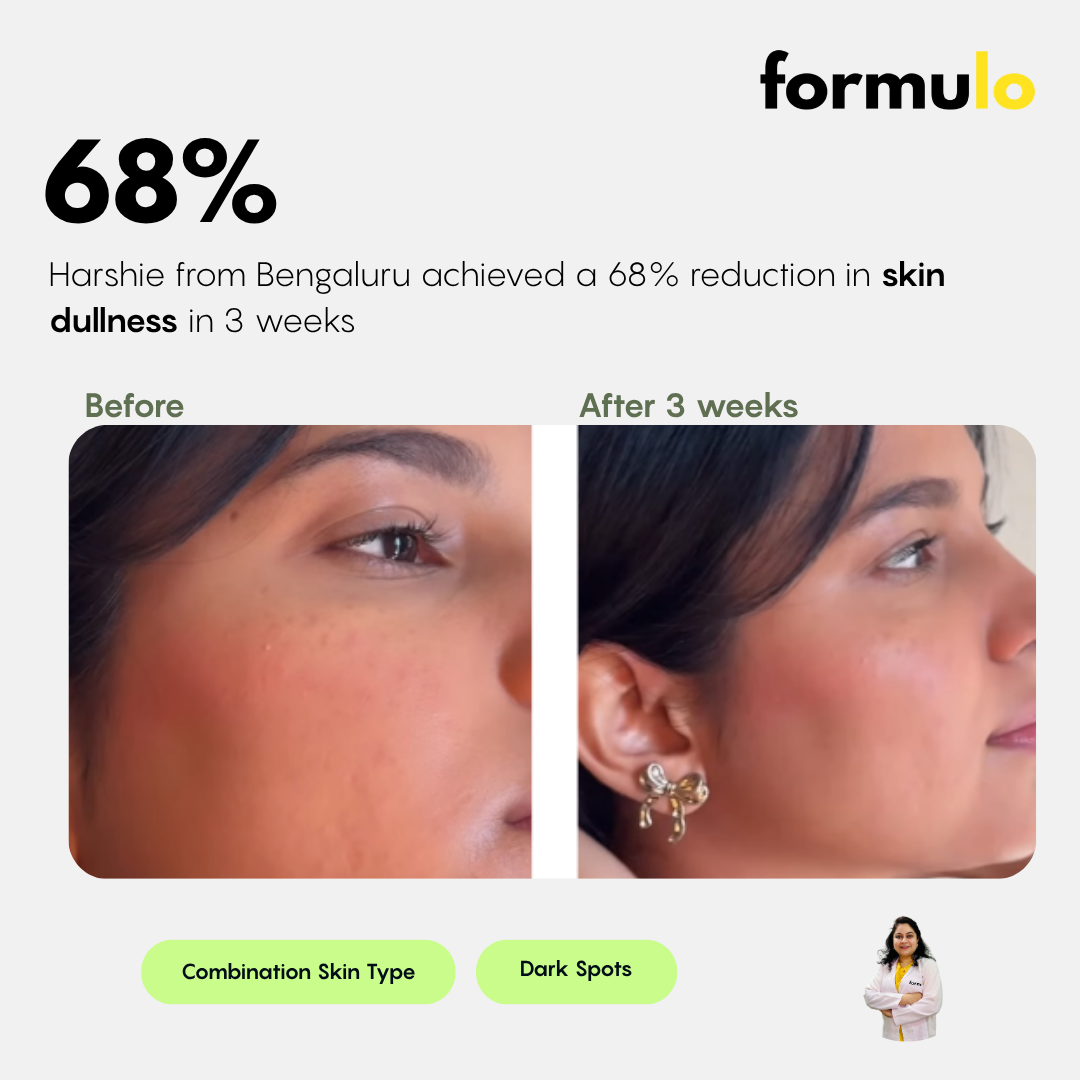 Dermatologist Consultation (Online)
