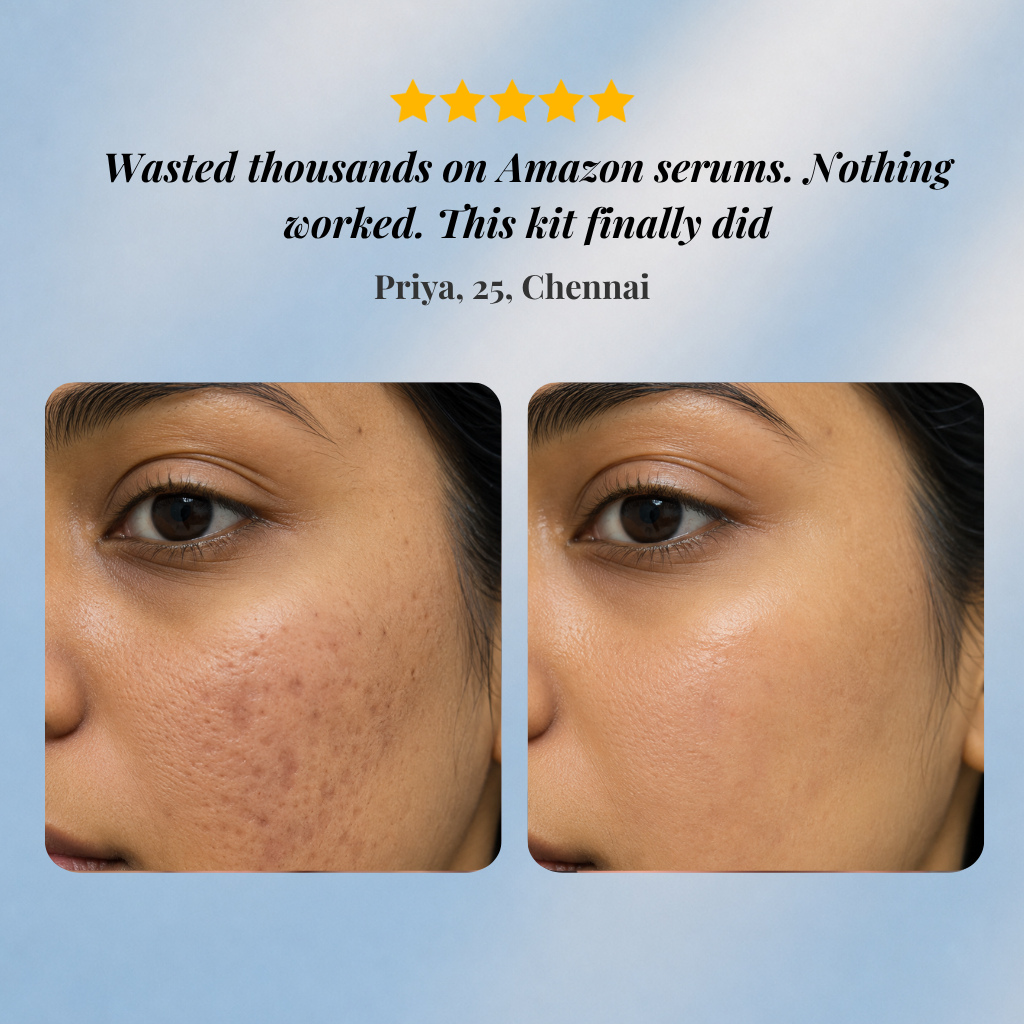 Acne Scar Treatment Kit