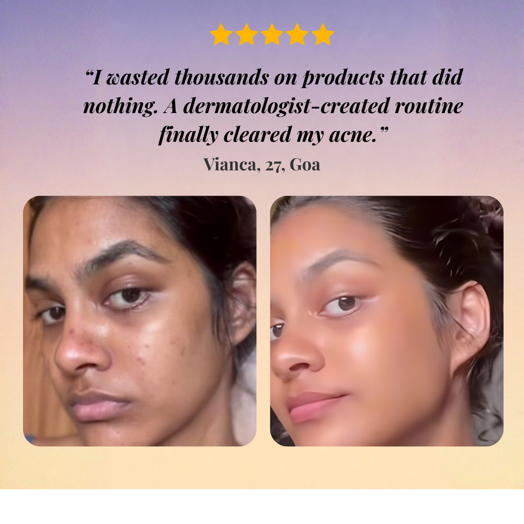 Oily Skin Acne Treatment Kit