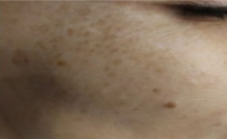 Two side-by-side images of a dog's face with a focus on skin texture and blemishes.