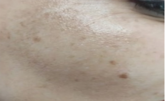  images of a dog's face with a focus on skin texture and blemishes.